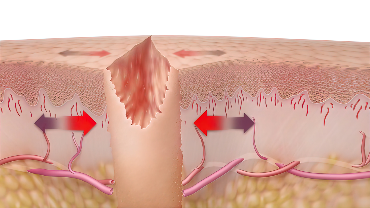 千库网_皮肤伤口愈合时间的-3D-医学插图_摄影图编号16624738.png